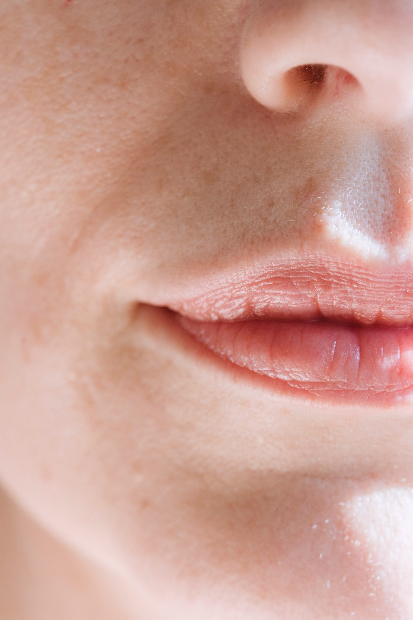 4) Lip Flip: The Benefits of Having a Lip Flip Near Me